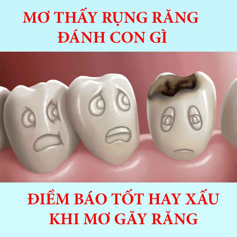 mơ thấy g&atilde;y răng